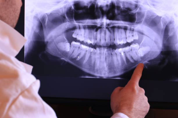 Best Urgent Care for Lost Fillings or Crowns in Wofford Heights, CA