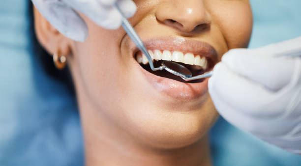 Best Emergency Dental Care for Broken or Chipped Teeth in Wofford Heights, CA