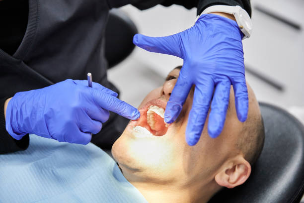 Best Emergency Dental Care for Broken or Chipped Teeth in Wofford Heights, CA